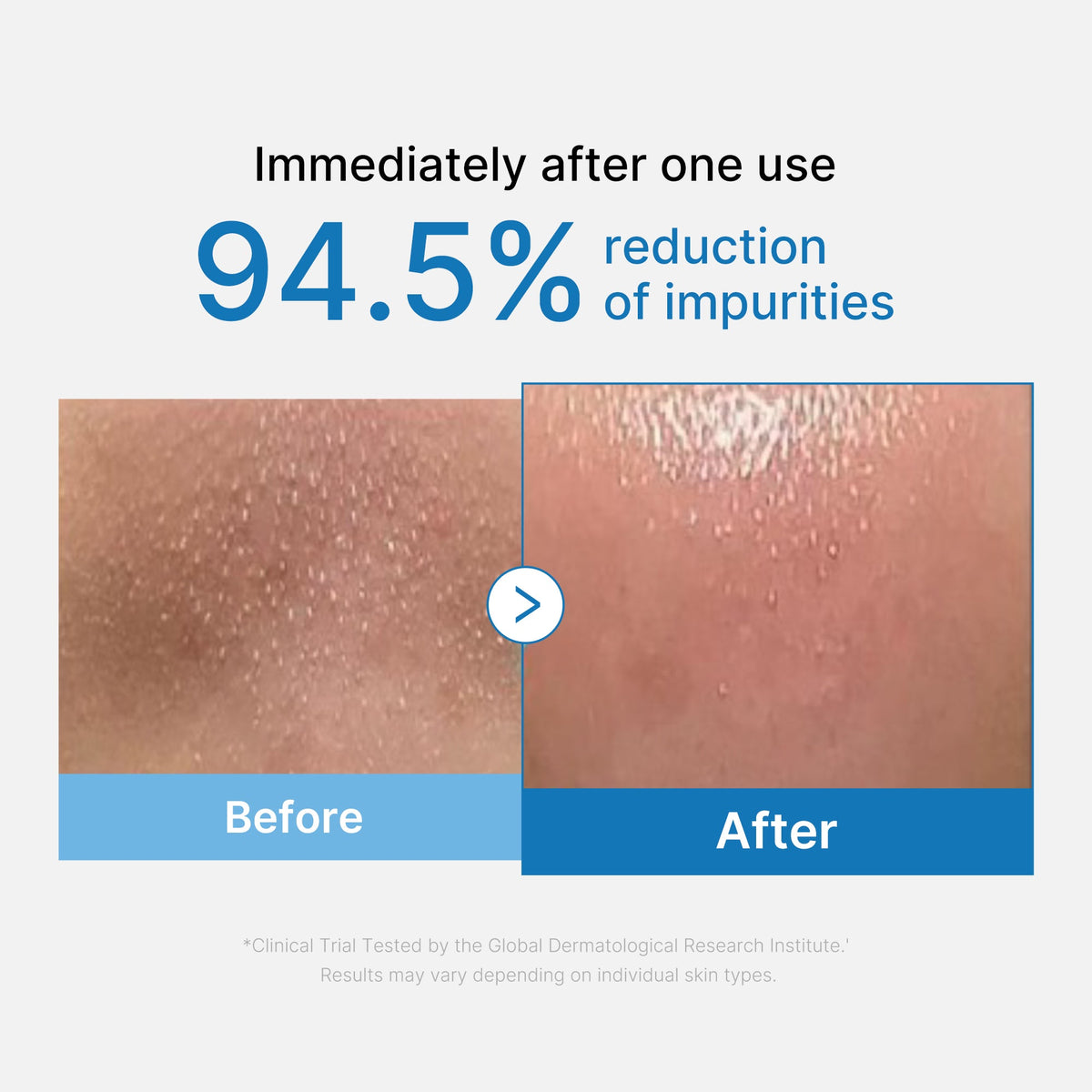 Zero Pore Blackhead Deep Cleansing Oil Q1
