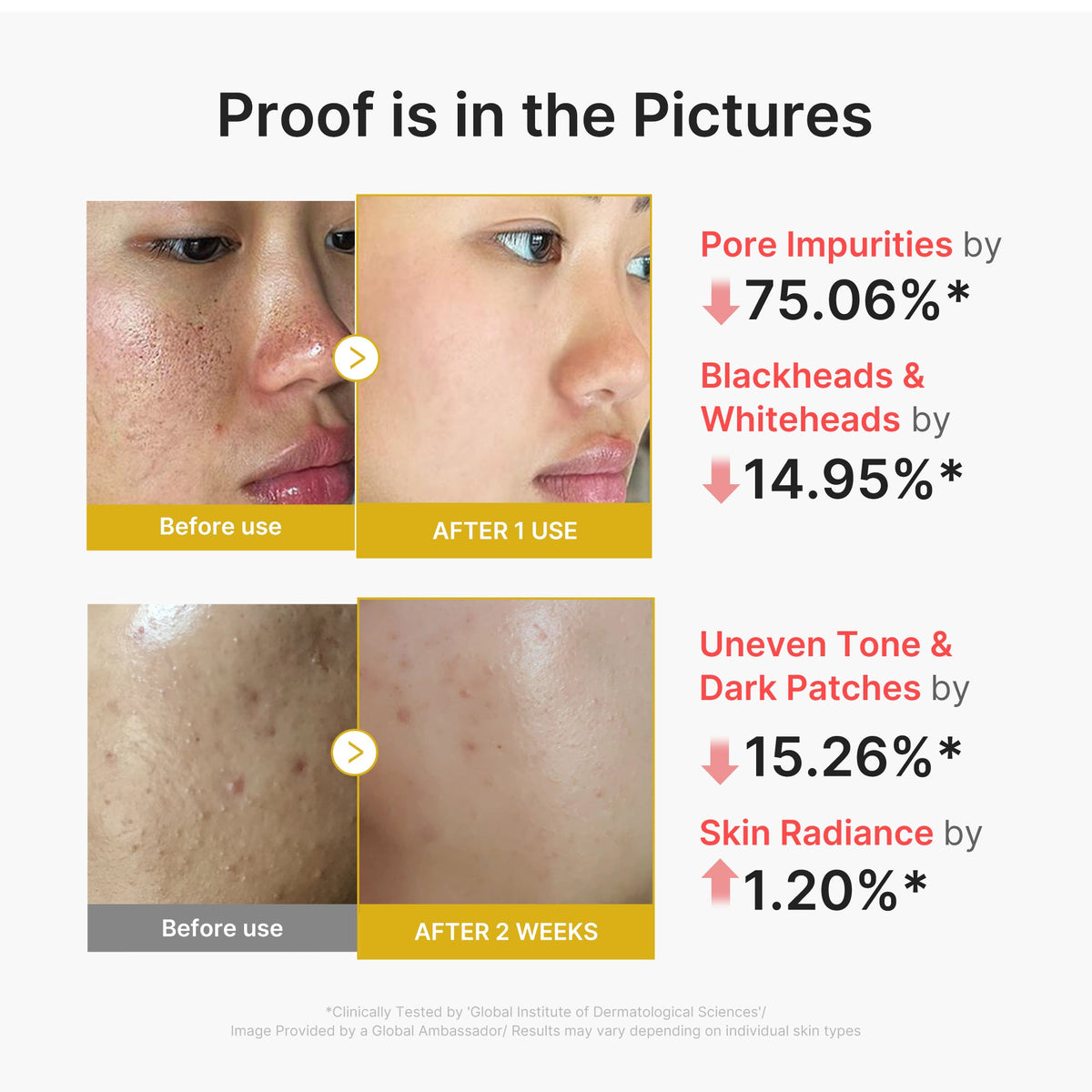 Kojic Acid Turmeric Peel Shot K7