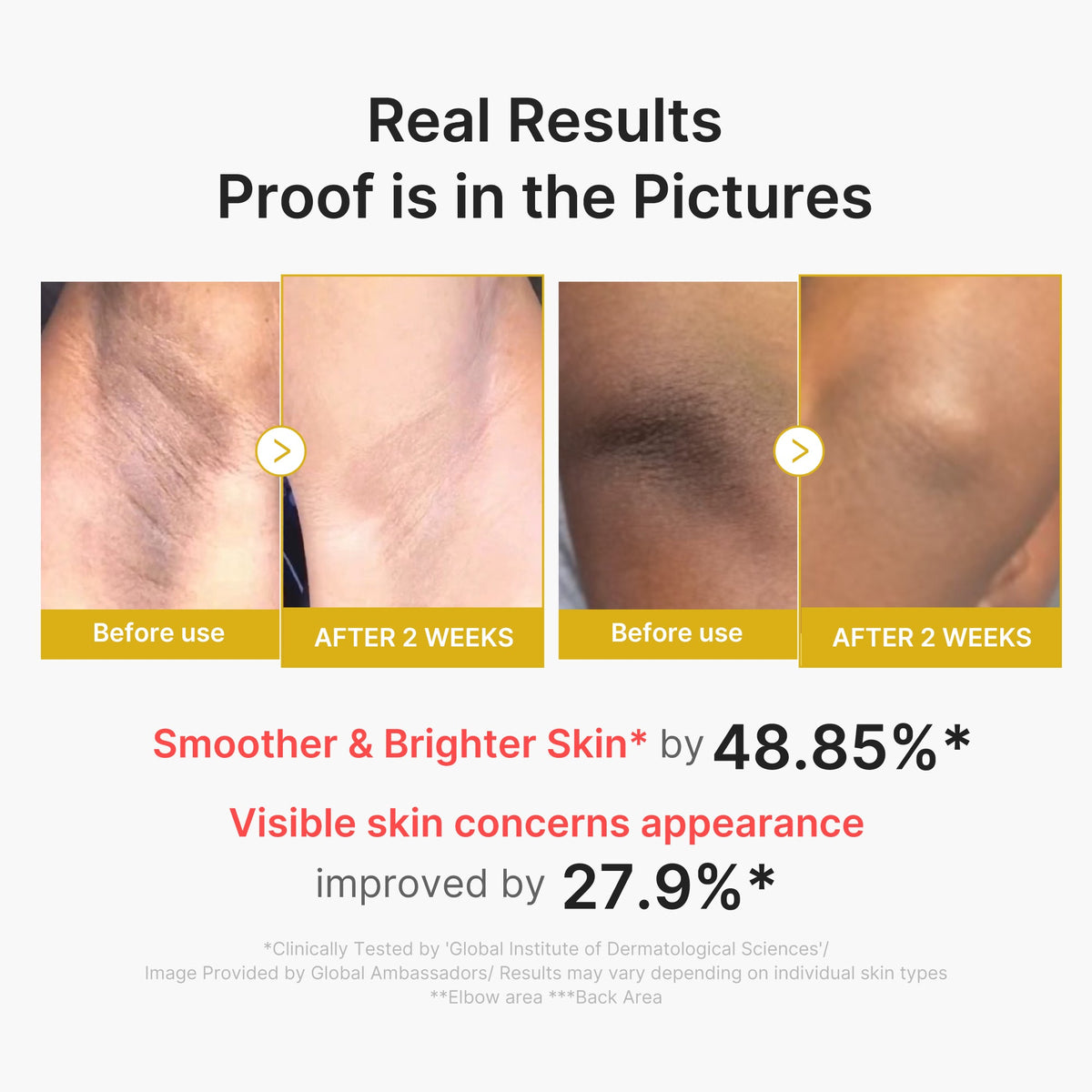 Kojic Acid Turmeric Body Peel Shot P6