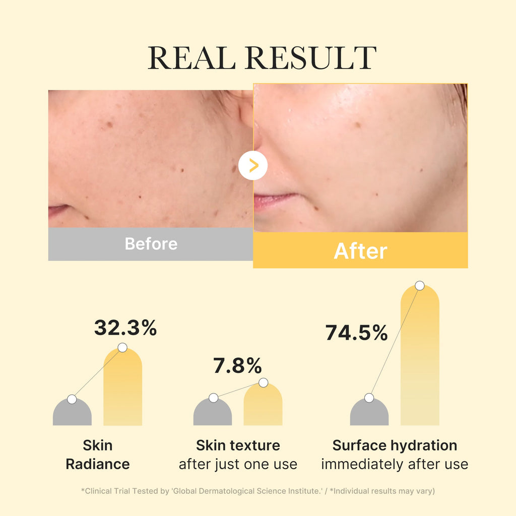 Kojic Acid Turmeric Gold Jelly Gel Mask Z1