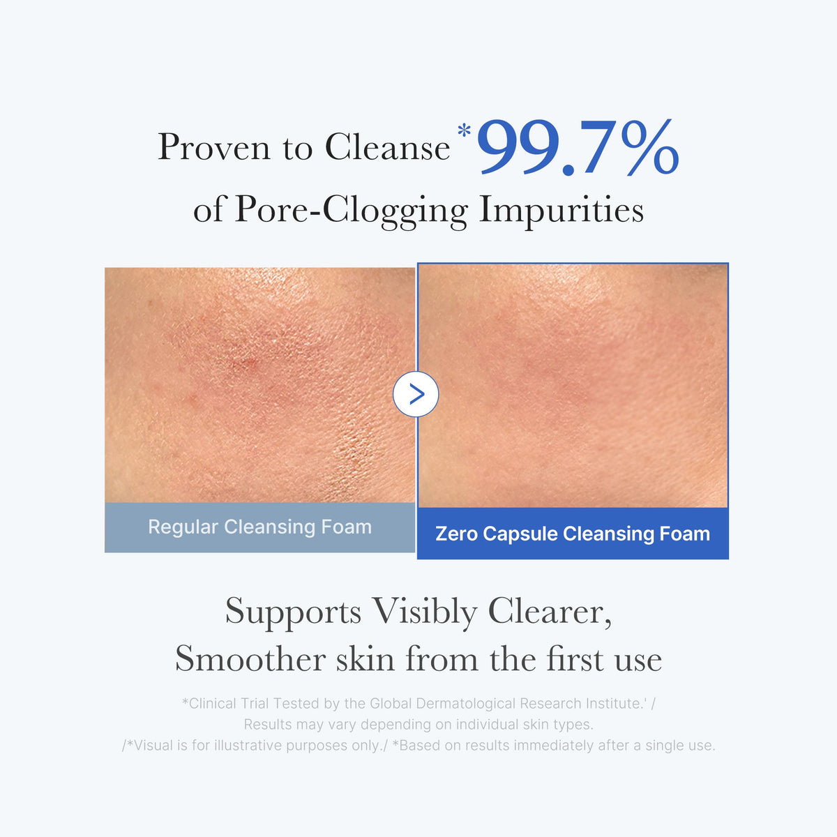 Zero Pore Capsule Cleansing Foam J0