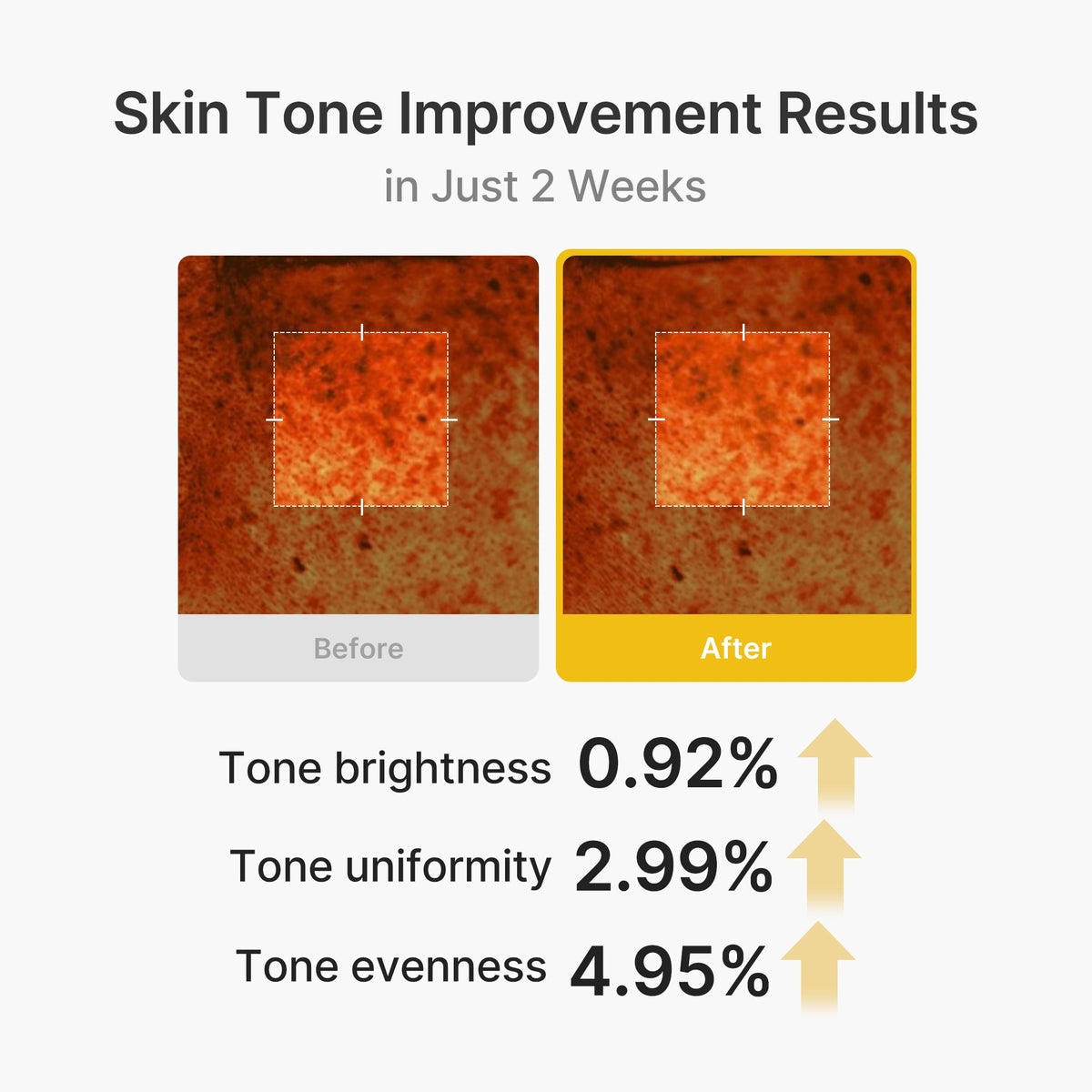 Kojic Acid Turmeric Vita Capsule Cream I4