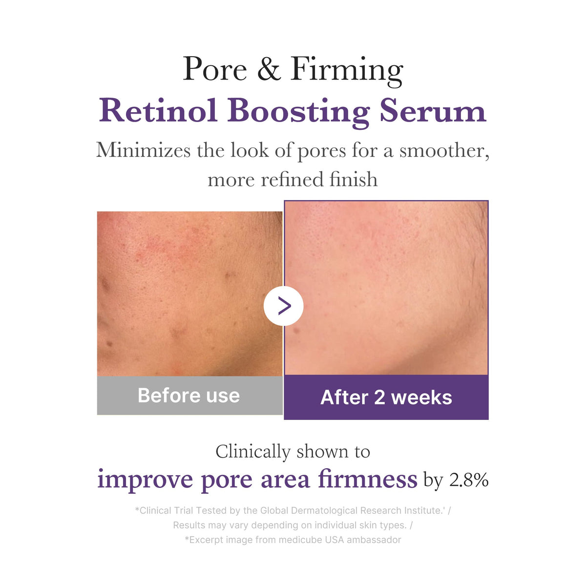 Retinol NMN Boosting Serum E5