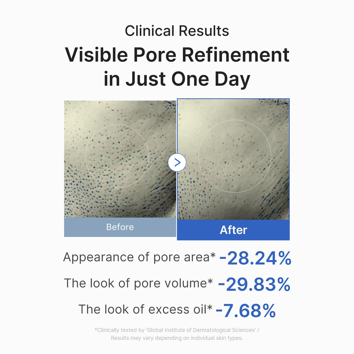 Zero Pore One-day Peptide Serum V6