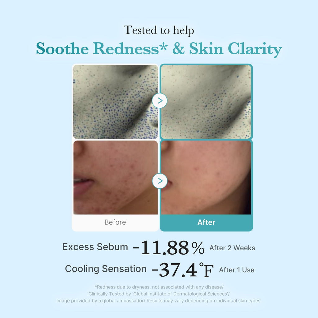 Azelaic Acid Niacinamide Clarifying Toner S8