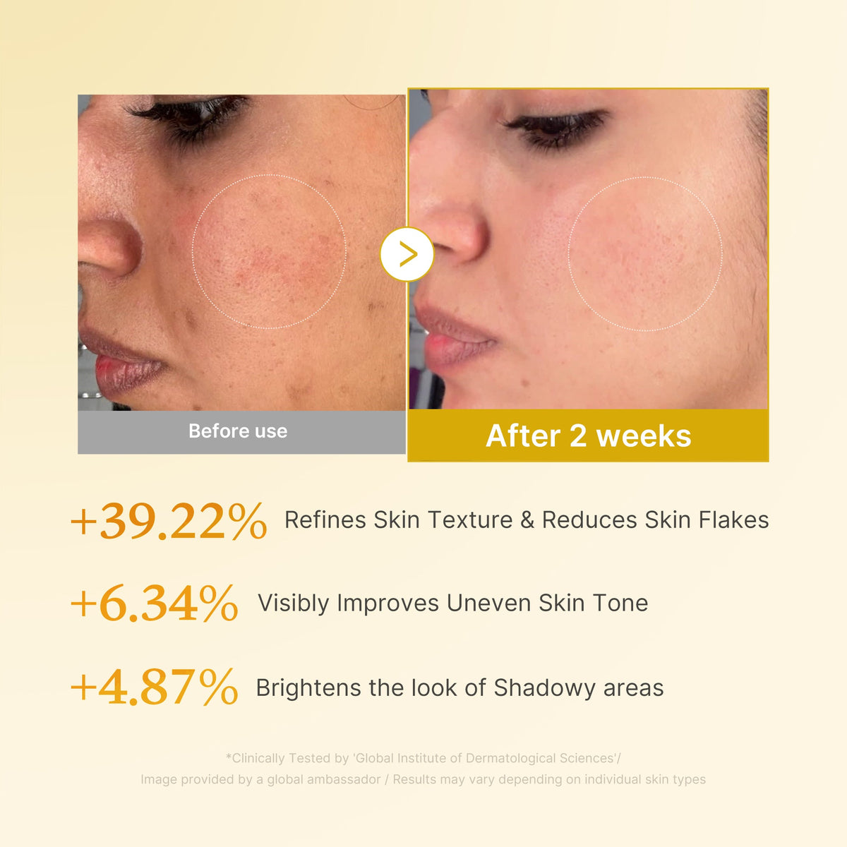 Kojic Acid Turmeric Toner E6