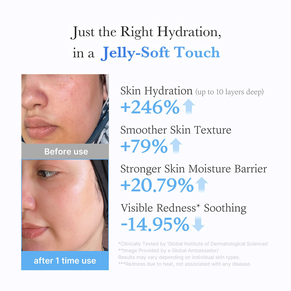 Hyaluronic Ceramide Moisturizing Jelly Cream Q9