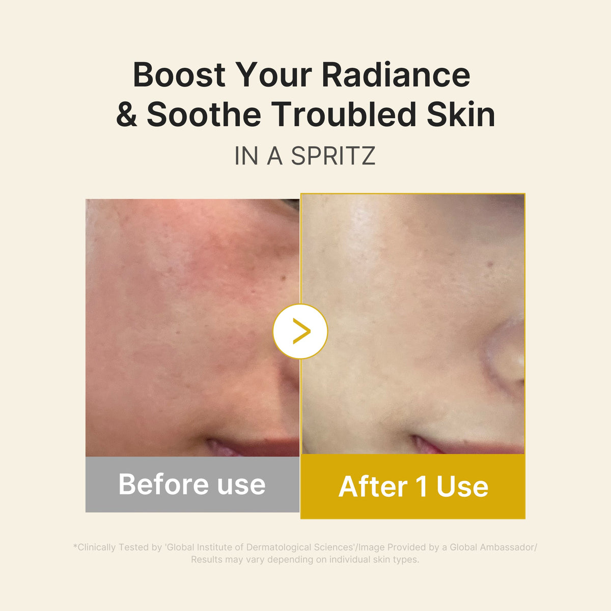 Kojic Acid Turmeric Vitamin Gold Jelly Mist Serum V0