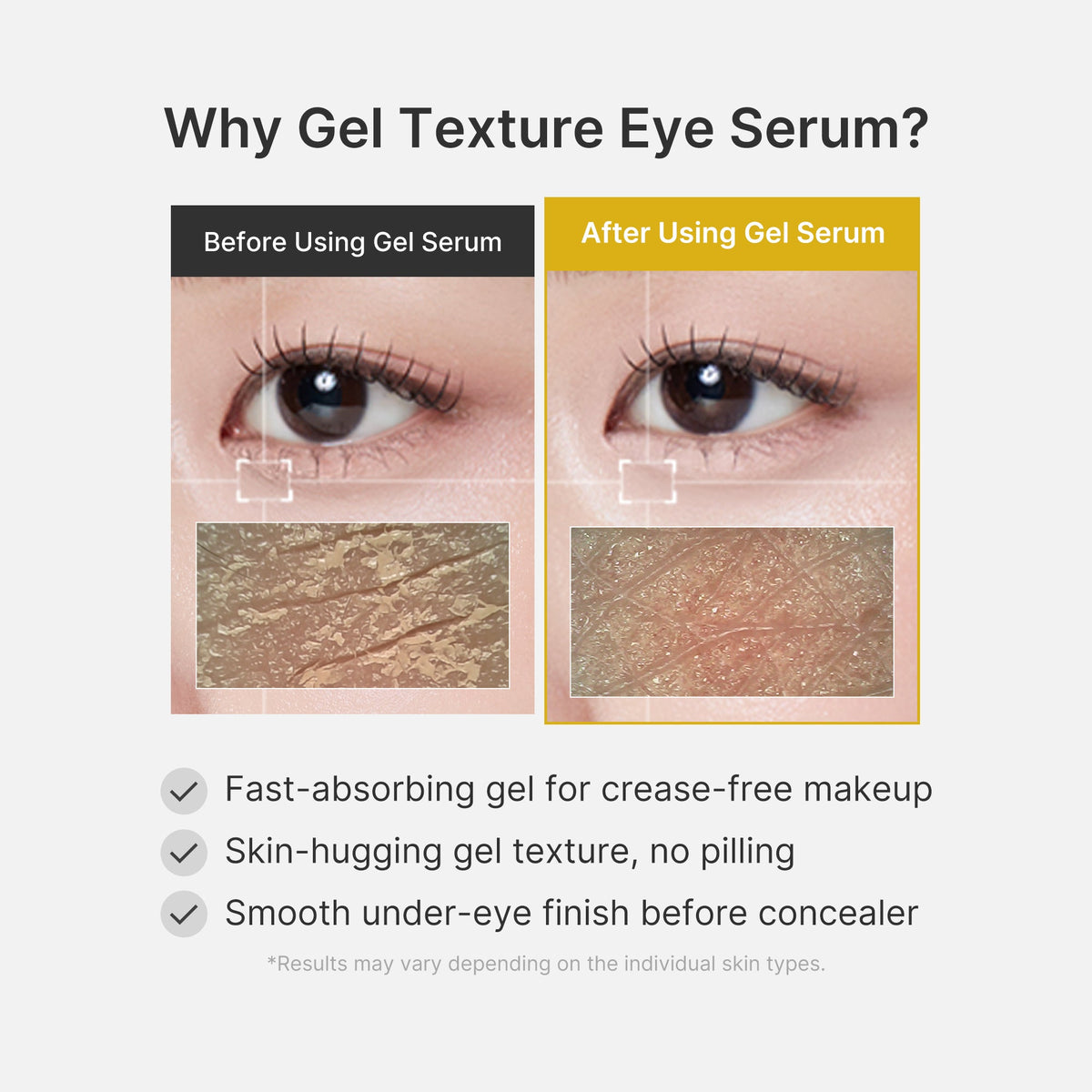 Kojic Acid Tumeric Eye Gel Serum I1