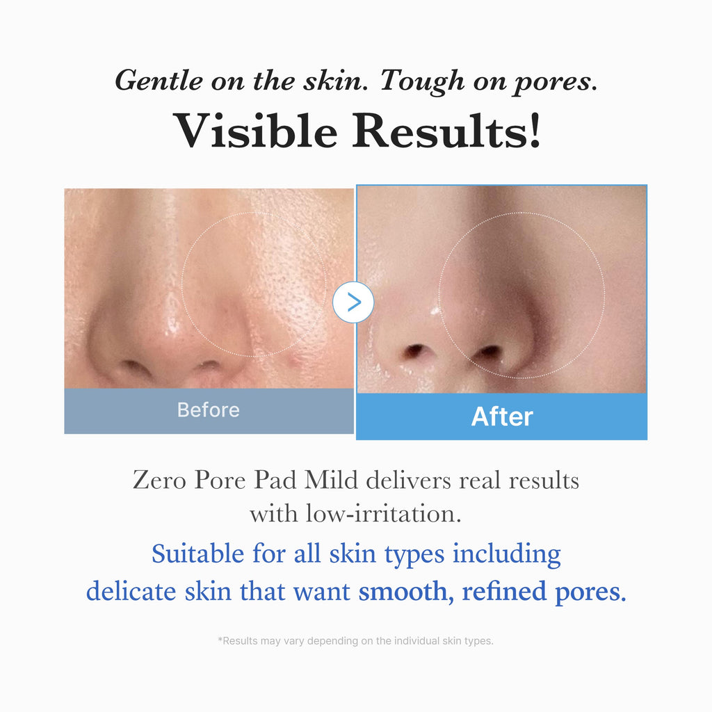 Zero Pore Madecassoside Pads (Mild) E5