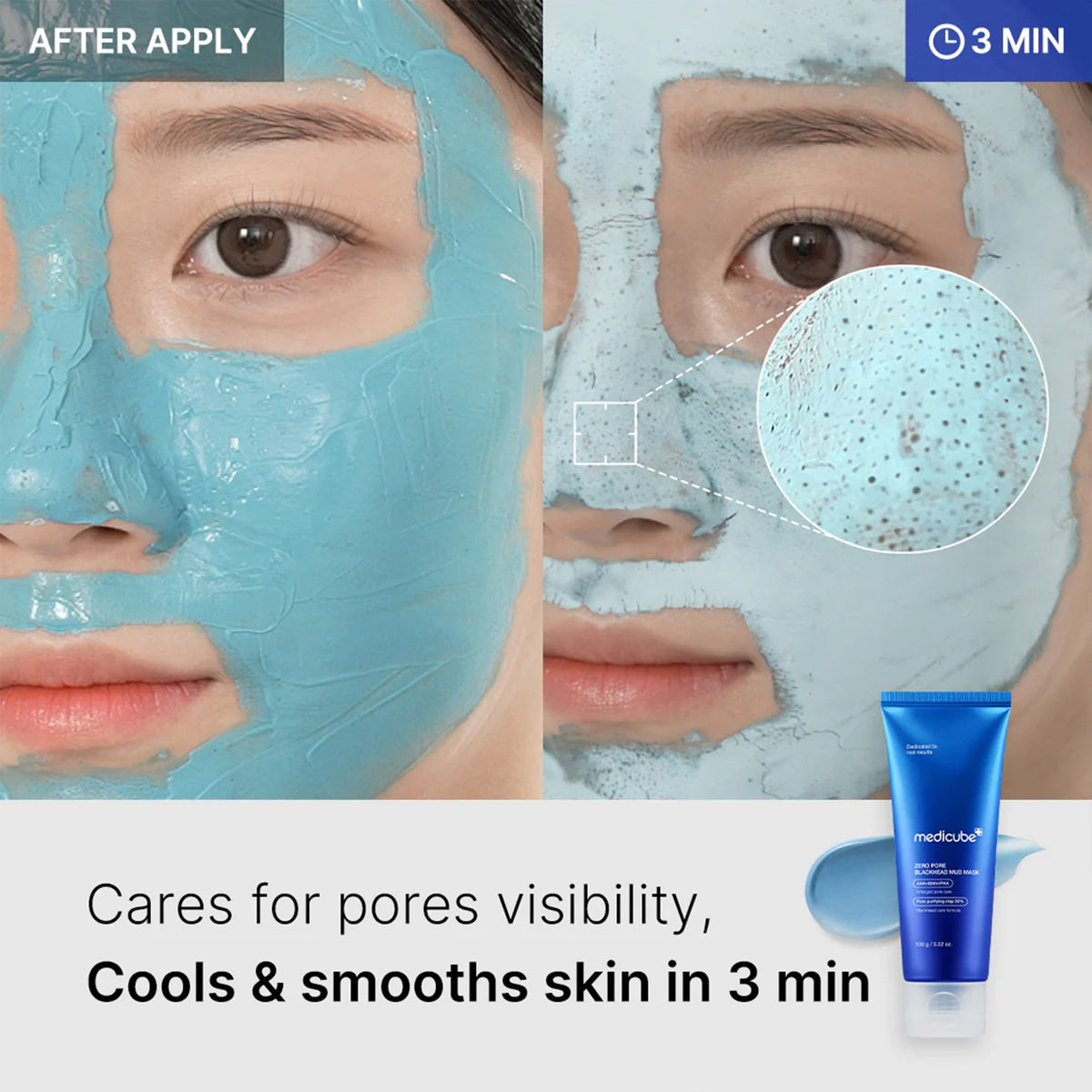 Zero Pore Blackhead Mud Mask Y0