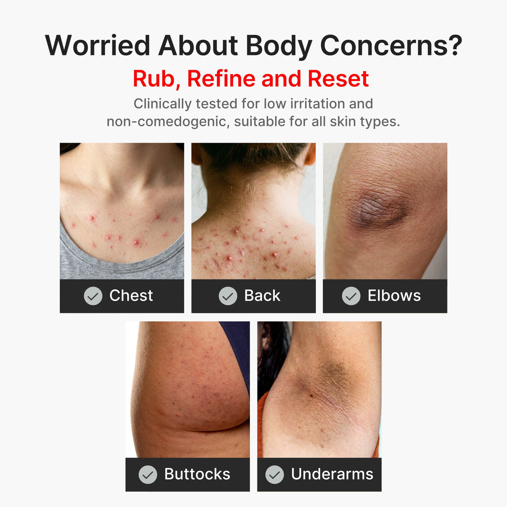Kojic Acid Turmeric Body Peel Shot P6
