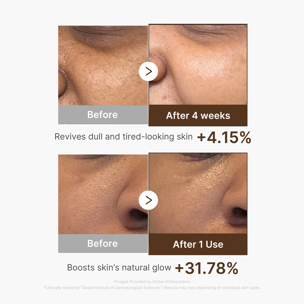 Deep Vitamin C Capsule Serum K9