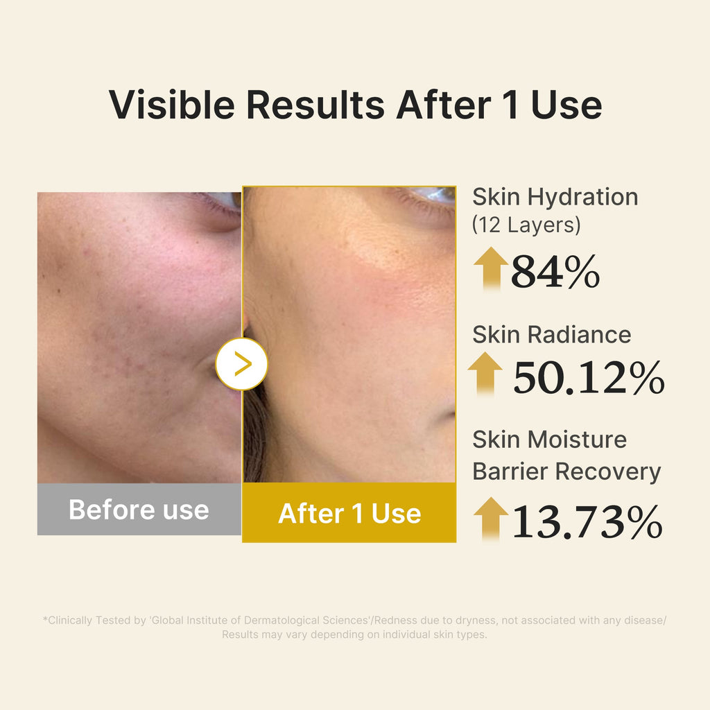 Kojic Acid Turmeric Vitamin Gold Jelly Mist Serum V0