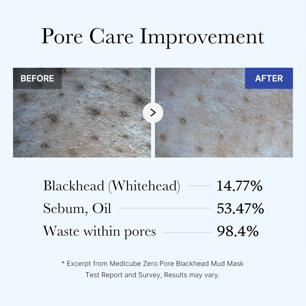 Zero Pore Blackhead Mud Mask Y0