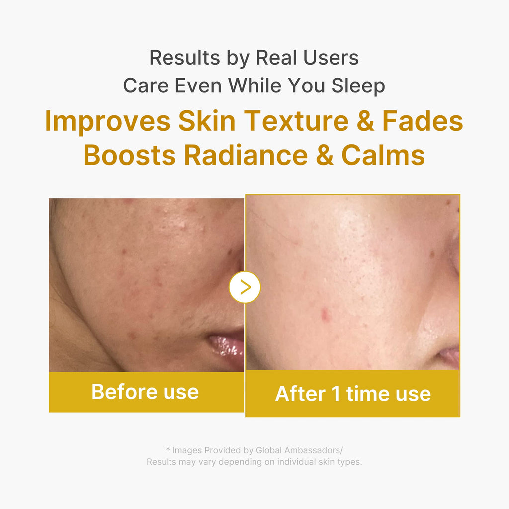 Kojic Acid Turmeric Overnight Wrapping Mask X9