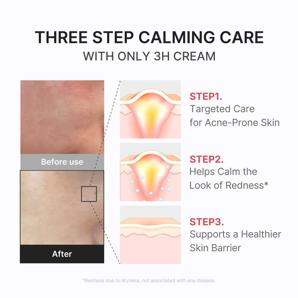 3H Daily Relief Cream M3