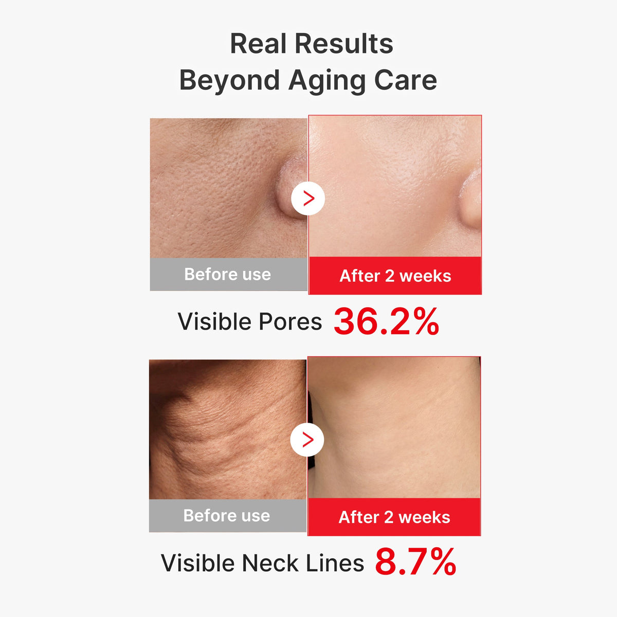 EGF NAD+ Firming Serum U4