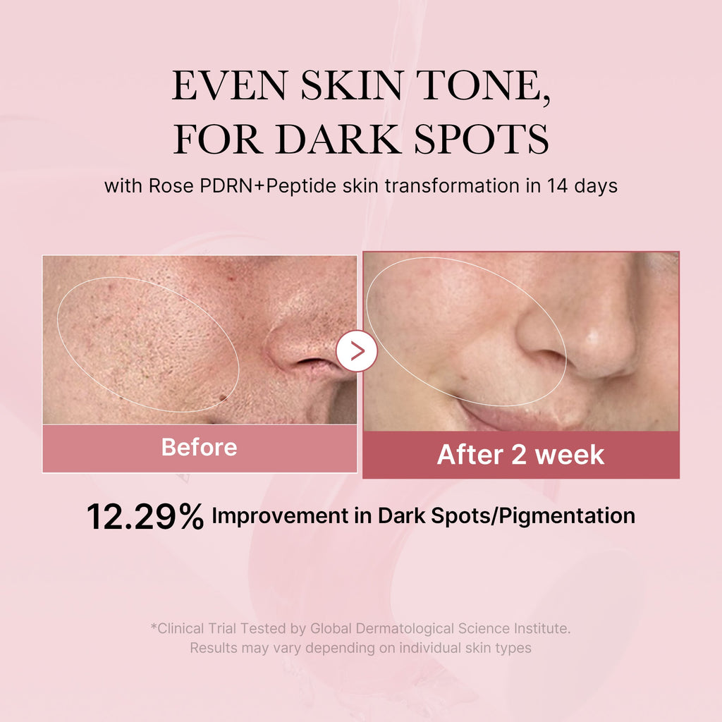 PDRN Pink Peptide Toner E1