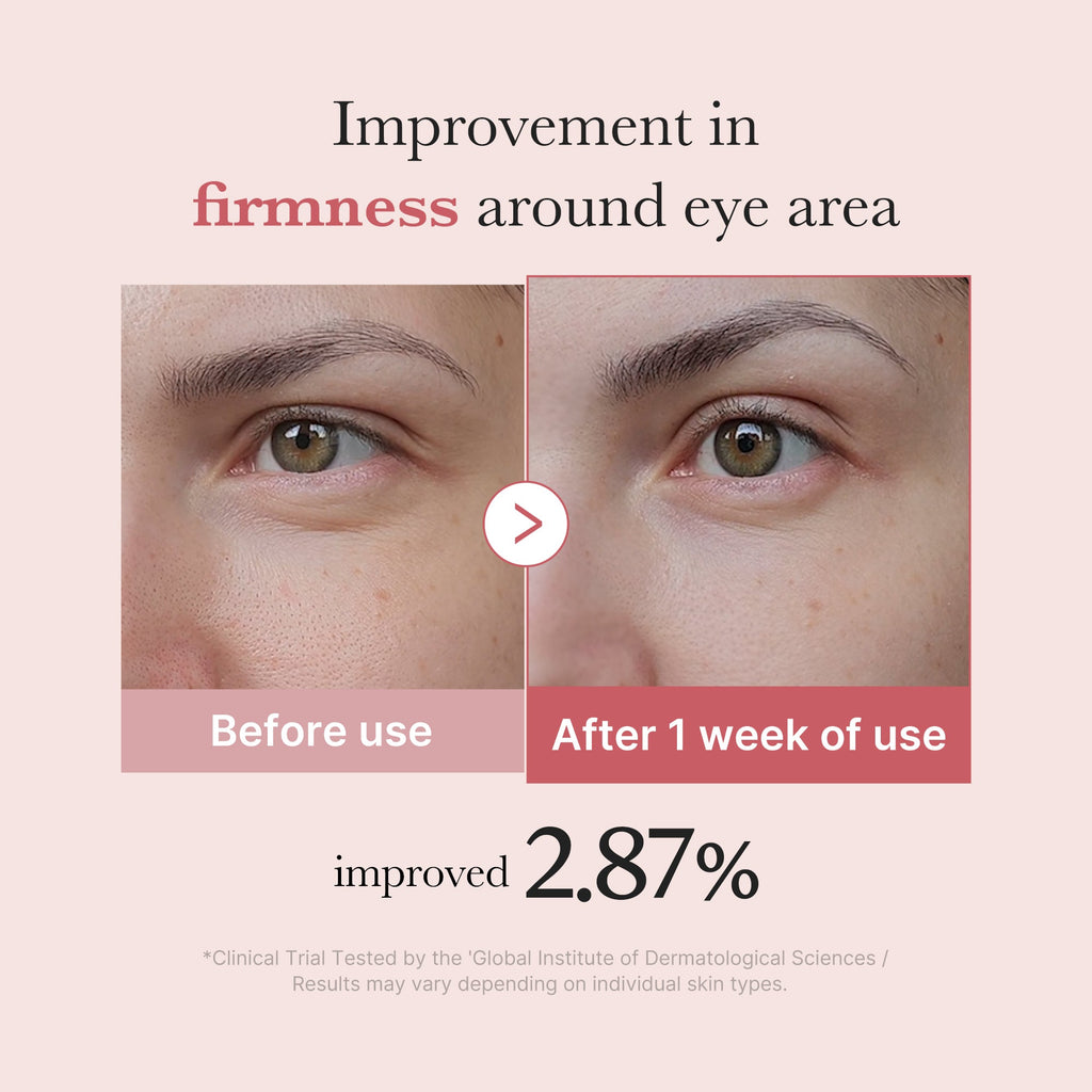 PDRN Pink Peptide Eye Cream X1