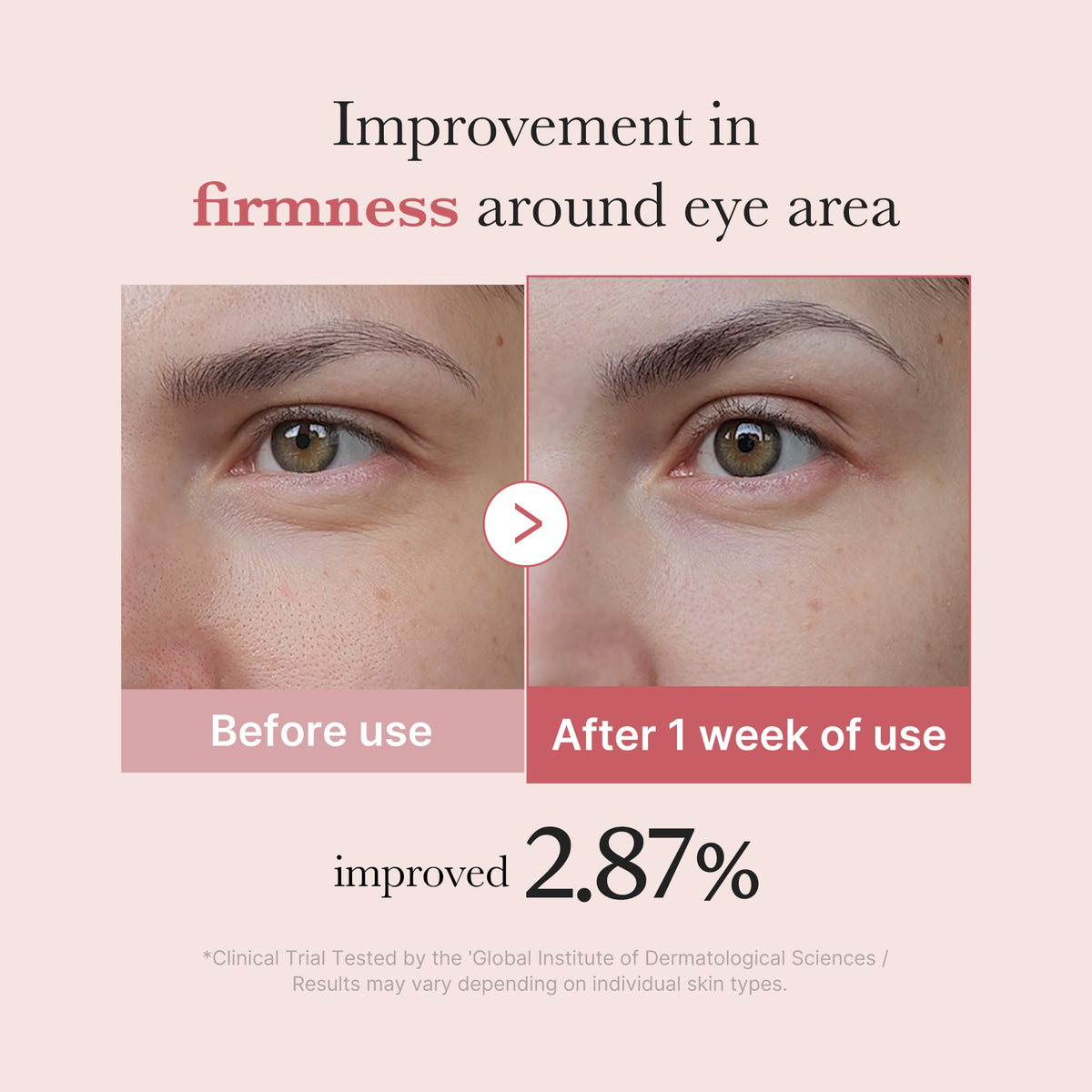 PDRN Pink Peptide Eye Cream X1