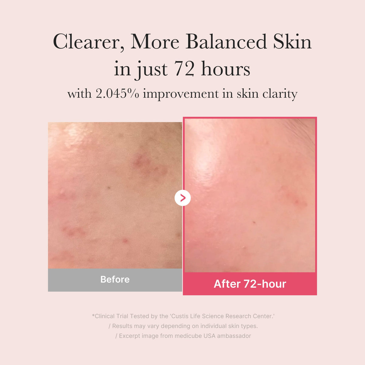 TXA Niacinamide Serum D0