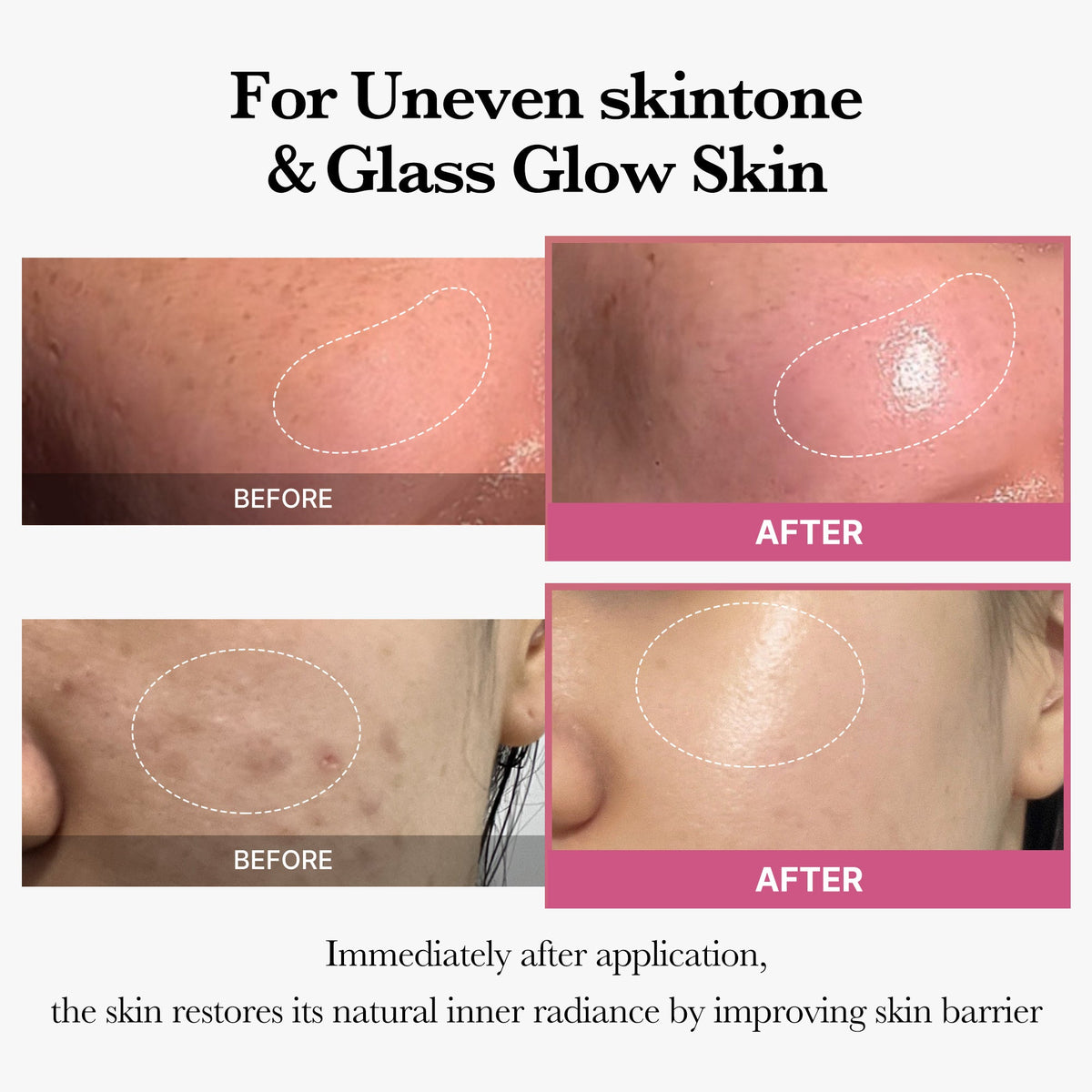 [Tati's Exclusive] All About Glow Set L1